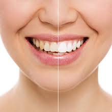 Best Ways How to Get Strong Teeth and Gums